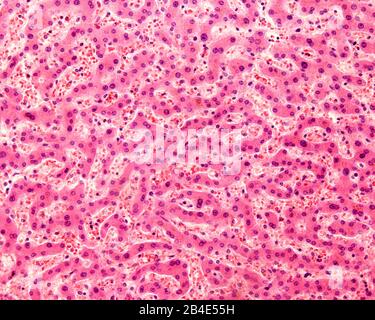 Micrographe léger d'un foie humain taché d'hématoxyline et d'éosine. Les hépatocytes sont disposés en cordons séparés par des zones claires où le péché hépatique est présent Banque D'Images