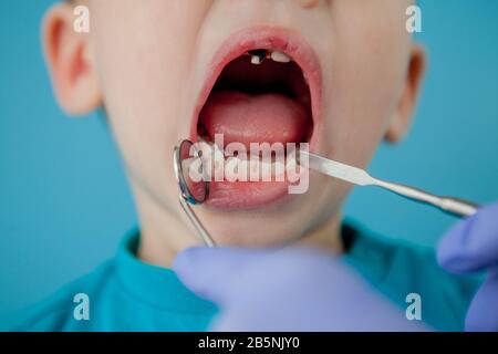 Gros plan sur les mains du dentiste avec l'assistant en gants bleus traitent les dents d'un enfant, le visage du patient est fermé Banque D'Images