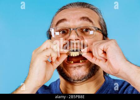 Main de l'homme mettant l'implant dentaire en gros plan temporaire dans le patient Banque D'Images