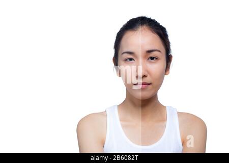 Belle jeune femme sur un fond blanc, beauté concept. Retoucher avant et après.face divisée en deux parties, mauvais état de la peau en bonne condi Banque D'Images