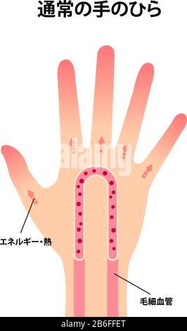 Illustration de la circulation sanguine normale de la main Illustration de Vecteur