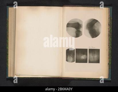 Trois röntgenfoto's Object Type : photo page Numéro d'article: RP-F 2005-26-31 Inscriptions / marques: Nom, recto, imprimé: 'Dr. Kaisin.' Fabricant : photographe : anonyme date: CA. 1904 - en avant ou en avant 1909 matériau: Papier photo technique: Gélatine argent dimensions de pression: Photo: H 106 mm × W 45 mmToelichtingFoto dans la section dans le boek arrière. Objet : squelette de l'examen radiographique (humain) Banque D'Images