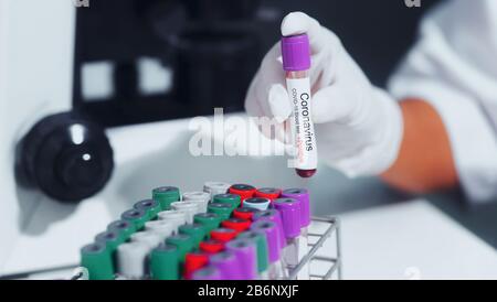 Résultat d'un test sanguin positif pour le nouveau Coronavirus.Coronavirus Covid 19 échantillon de sang infecté dans le tube d'échantillon à la main du scientifique Banque D'Images