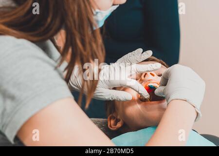 Le garçon avec sa bouche ouverte se trouve dans la chaise du dentiste alors que l'orthodontiste tient la plaque sur ses dents.2020 Banque D'Images