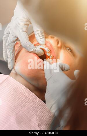 Le garçon avec sa bouche ouverte se trouve dans la chaise du dentiste alors que l'orthodontiste tient la plaque sur ses dents.2020 Banque D'Images