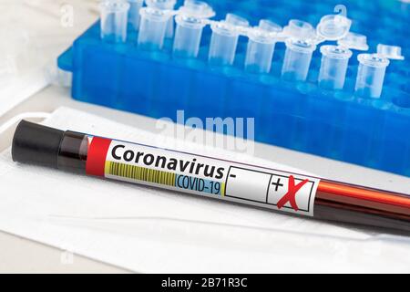 Tube D'Essai Positif De Sang De Coronavirus Posé Sur La Table De Laboratoire. Banque D'Images