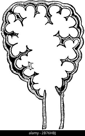 Cette illustration représente le bule pulmonaire, le dessin de lignes anciennes ou l'illustration de gravure. Illustration de Vecteur