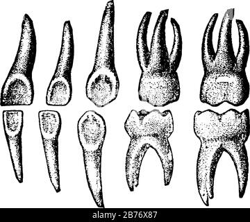 Les dents temporaires, également appelées dents primaires ou dents de bébé, sont le premier ensemble de dents dans le développement de la croissance des humains, dessin vintage de ligne ou Illustration de Vecteur