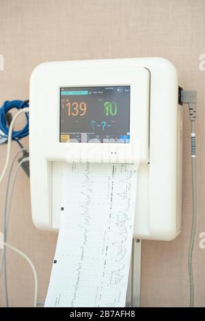 Appareil d'électrocardiographie connu couramment comme examen CTG, test. Surveillance de la fréquence cardiaque et de la pression du bébé à naître. Banque D'Images