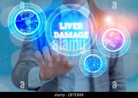 Écriture de texte écriture de dommages au foie. Photo conceptuelle atteinte au foie et à sa fonction en raison de l'abus d'alcool éléments de cette image fournie par Banque D'Images