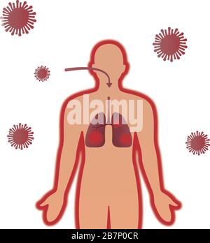 Wuhan coronavirus covit 19 apparenté , caractère humain, infection pulmonaire ou virus défectueux poumons et bactéries dangereuses pour la santé vecteurs illustration Illustration de Vecteur