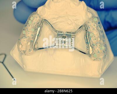 Turbine d'expansion rapide palatine sur les dents de gypse en fonte par le dentiste. Contrôle des dents avec les supports Banque D'Images