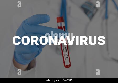 Le médecin tient un tube à essai. Test sanguin, test positif du virus corona Banque D'Images