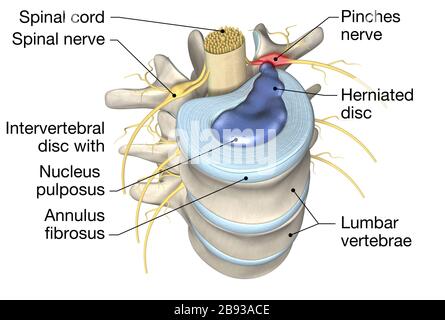 Illustration tridimensionnelle montrant une vertèbre lombaire avec disque intervertébral, illustration tridimensionnelle médicale Banque D'Images