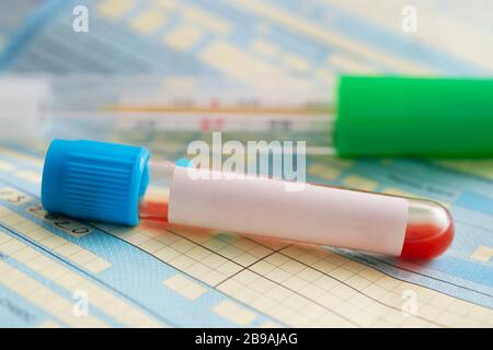 Tube de test sanguin avec thermomètre pour l'examen du patient. Sang dans les tubes à essai et formulaire d'enquête avec étiquette vierge pour le diagnostic ou le patient Banque D'Images