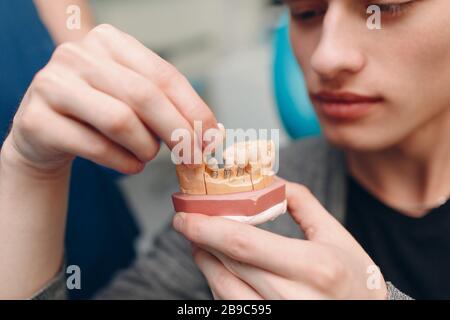 Dentisterie. Le dentiste montre des implants au patient. Clinique dentaire. Banque D'Images