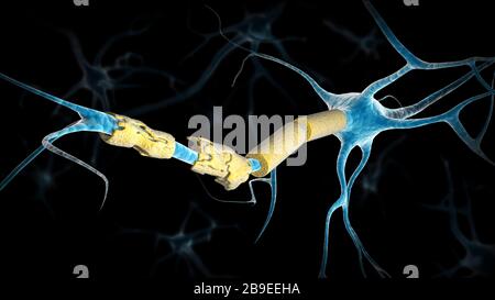 Image conceptuelle d'un neurone de sclérose en plaques. Banque D'Images
