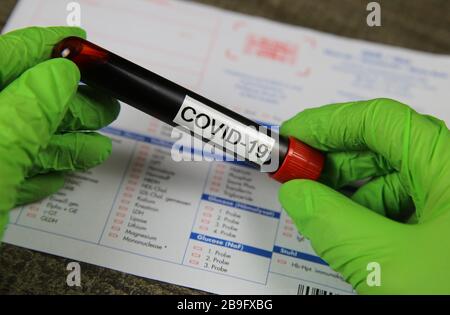 Viersen, Allemagne - 22 mars. 2020: Gros plan sur les mains isolées avec des gants verts tenant le flacon d'échantillon de sang avec le mot covid-19. Demande de test de laboratoire floue Banque D'Images