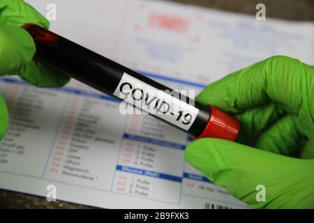 Viersen, Allemagne - 22 mars. 2020: Gros plan sur les mains isolées avec des gants verts tenant le flacon d'échantillon de sang avec le mot covid-19. Demande de test de laboratoire floue Banque D'Images