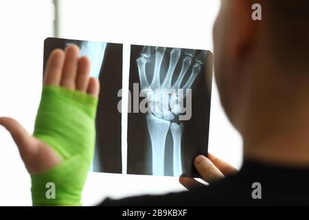 Le patient masculin tient en main l'acquisition CT de son bras cassé lors d'un rendez-vous avec le médecin Banque D'Images