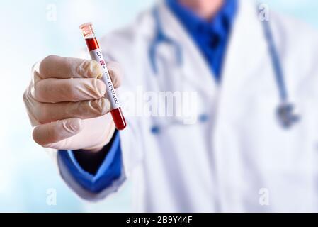 Personnel médical dans des gants de protection et de robe montrant le tube avec test positif de covid-19 Banque D'Images