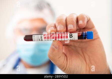 Vue d'un médecin portant un échantillon de sang de tube à essai fictif, infecté par le virus de l'hépatite B. Banque D'Images