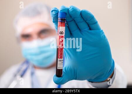 Vue d'un médecin portant un échantillon de sang de tube à essai fictif, infecté par le virus de l'hépatite B. Banque D'Images