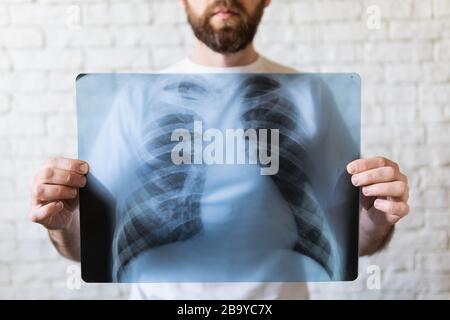 Jeune homme barbu tenant le film radiographique des poumons et du coeur devant sa poitrine, fond blanc Banque D'Images
