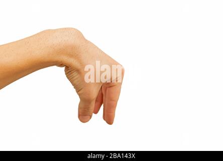 Kyste de ganglion dans le poignet isolé sur fond blanc Banque D'Images