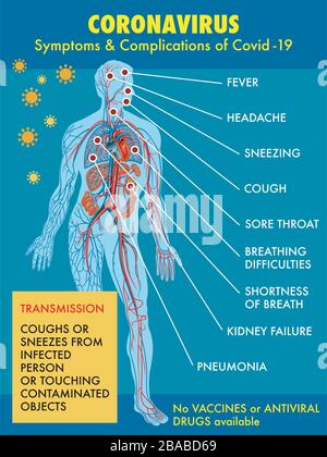 Schéma des symptômes et des complications du coronavirus (Covid-19) Illustration de Vecteur