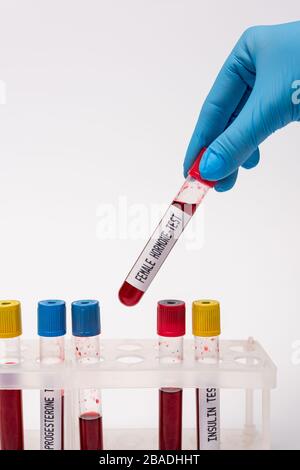 Vue rognée du médecin tenant le tube d'essai avec l'hormone femelle test près des échantillons de sang dans le stand isolé sur blanc Banque D'Images