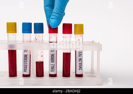 Vue rognée du médecin tenant un échantillon sanguin de test d'hormone femelle près des tubes à essai en position debout sur fond blanc Banque D'Images