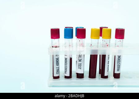 Tubes à essai avec échantillons sanguins d'insuline et d'hormones tests en position isolée sur bleu Banque D'Images