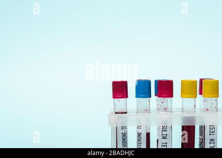 Tubes à essai avec des échantillons sanguins d'hormones tests dans un support isolé sur bleu Banque D'Images