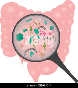 Prolifération bactérienne dans l'intestin grêle Illustration de Vecteur