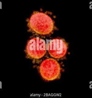 Micrographe électronique de transmission des particules du virus du SRAS-COV-2, isolé d'un patient. Image capturée et rehaussée de couleurs au NIAID Integrated Research Facility (IRF) de fort Detrick, Maryland. Banque D'Images