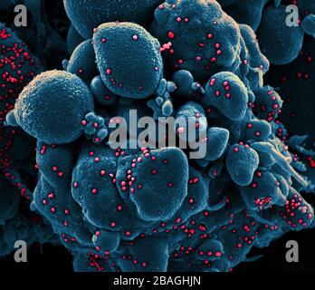 Micrographe électronique à balayage colorisé d'une cellule apoptotique (verte) infectée par les particules du virus SRAS-COV-2 (jaune), isolée d'un échantillon de patient. Image capturée à la NIAID Integrated Research Facility (IRF) à fort Detrick, Maryland. Banque D'Images