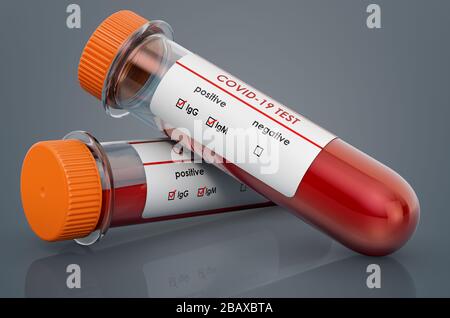 COVID-19, tube de test avec échantillon sanguin positif pour le test de coronavirus COVID-19, rendu tridimensionnel Banque D'Images