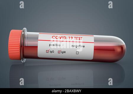 Test du coronavirus, COVID-19. Tube de test avec échantillons de sang positifs pour le test de Coronavirus COVID-19, rendu tridimensionnel Banque D'Images