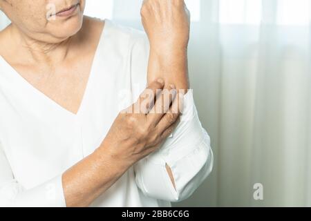 les femmes âgées gratent la main sur le bras de l'eczéma, les soins de santé et le concept de médecine Banque D'Images