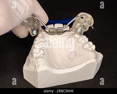 Expandeur palatal pour le maxilla, test de réglage. L'appareil orthodontique amovible pour élargir la mâchoire supérieure. Couramment utilisé pour traiter les enfants avec Banque D'Images