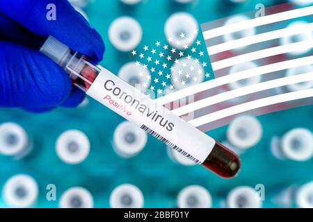 Le travailleur de la santé possède un tube d'essai indiquant des résultats positifs du test du virus corona. Drapeau des Etats-Unis et de nombreux tubes de sang-tests comme un fond. Banque D'Images