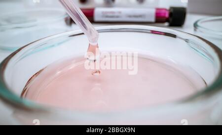 Scientifique déposer un échantillon dans un plat de Petri. Expérimenté en laboratoire avec pipette ajoutant du liquide de biochimie essais médicaux. Équipement A Banque D'Images