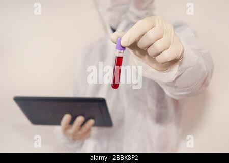 tube de test sanguin dans les mains d'une femme sur fond blanc. comprimé et tube de test dans les mains de l'assistant de laboratoire dans un laboratoire scientifique. concept Banque D'Images