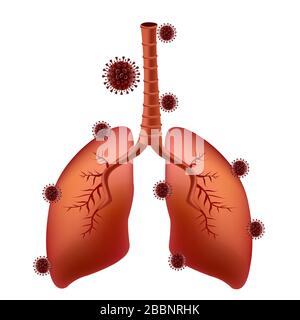 le virus corona covid-19 adhère aux poumons du patient pulmonaire Banque D'Images