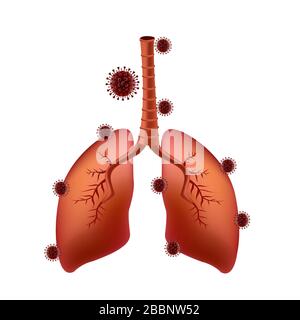 le virus corona covid-19 adhère aux poumons du patient pulmonaire Illustration de Vecteur
