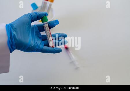 Tubes de test sanguin en laboratoire, échantillons sanguins, échantillon de sang de test covid-19, image conceptuelle. Banque D'Images