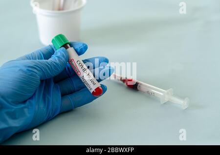 Tubes de test sanguin en laboratoire, échantillons sanguins, échantillon de sang de test covid-19, image conceptuelle. Banque D'Images