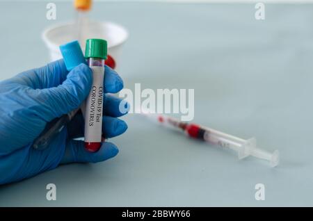 Tubes de test sanguin en laboratoire, échantillons sanguins, échantillon de sang de test covid-19, image conceptuelle. Banque D'Images