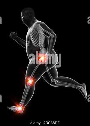 Articulations douloureuses du coureur obèse, illustration. Banque D'Images